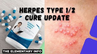 Herpes type 12 Cure Update  The Elementary Info [upl. by Jennie441]