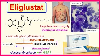 eliglustat [upl. by Assetal]