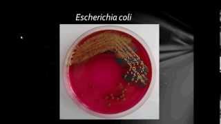 Bacteriology Gram Negative Bacilli Part1 [upl. by Suirtimid610]