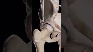 Hip Arthrosis When the Hip Joint Wears Down 🦴📚🥼 medical doctor ortho bone shortvideo video [upl. by Kasey]