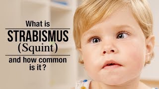 Strabismus in Kids  Cause and Treatment  Squint Eye [upl. by Htebesile407]