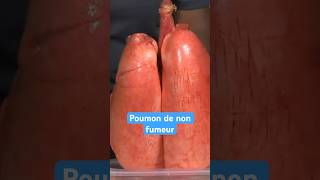 Poumon de fumeur VS non fumeur [upl. by Anicart]