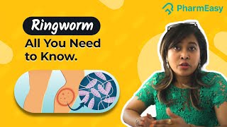 Treatment for Ringworm and Fungal Infection  Dr Soma Sarkar PharmEasy [upl. by Atir]