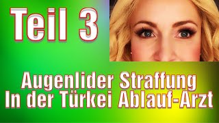 Augenlidstraffung Türkei Erfahrung Medical Exclusive Vorher Nachher Schlupflider entfernen [upl. by Flo]