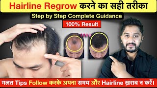 100 Result  Hairline Growth Tips 2023  Receding Hairline से छुटकारा [upl. by Aiynat961]