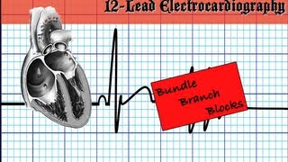 Bundle Branch Blocks  Part 2 [upl. by Mchail]