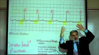 CARDIAC PHYSIOLOGY PART 3 by Professor Finkwmv [upl. by Ogata]