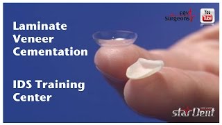 Laminate Veneer Cementation Live Demo IDS Training Center [upl. by Ariaek]