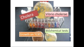 Cholera  Vibrio cholerae [upl. by Ayikat]