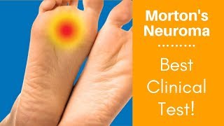 Mortons Neuroma Best Clinical Test [upl. by Lindemann147]