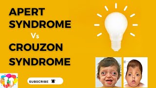 Apert syndrome VS Crouzon syndrome [upl. by Suolekcin]