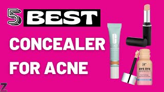 ✅😍Top 5 Best Concealers for AcneProne Oily Sensitive amp Dry Skin  2023 Buyers Guide [upl. by Ariada485]