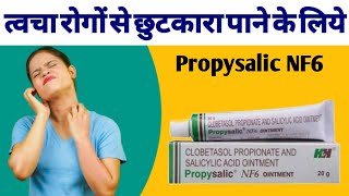 Propsaslic NF6 Ointment Uses Benefits And Side Effects In hindi  Clobetasol Propionate Cream [upl. by Trovillion907]