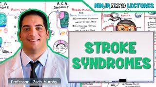 Stroke Syndromes MCA ACA ICA PCA Vertebrobasilar Artery Strokes  Pathophysiology [upl. by Oetsira]