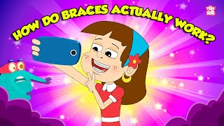 How Do Braces Work  How Teeth Aligners Work  Orthodontic Treatment  The Dr Binocs Show [upl. by Derfnam]