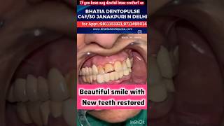 ब्रिजिंग के माध्यम से नए दांत लगाने का सबसे अच्छा तरीकाDental Bridging for fixing new teeth [upl. by Piegari]