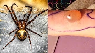 MOST Venomous Spiders On Earth [upl. by Thurmond]