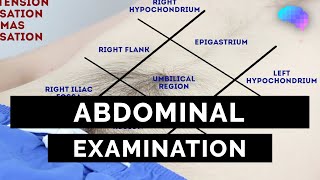 Abdominal Examination  OSCE Guide Latest  UKMLA  CPSA [upl. by Brigham]