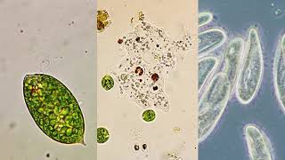 Microorganism moving methods  Flagella Pseudopodia and Cilia [upl. by Ungley]