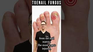 How to Know If Toenail Fungus is Dying How Fast Do Nails Grow [upl. by Lashond]