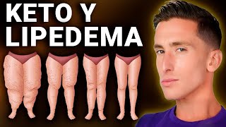 La dieta cetogénica tu mejor aliada ante el lipedema [upl. by Florrie]