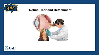 Retinal Tear and Detachment  Quiz [upl. by Htiaf]