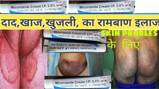 miconazole cream uses  veginal Yeast infection  antifungal  itching दाद खुजली [upl. by Acireit]