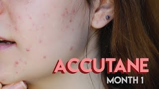 my first month on Accutane [upl. by Filomena465]