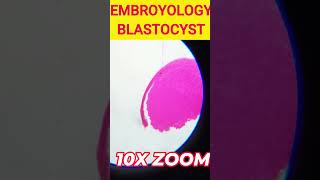 Embroyology Blastocyst cbsebiology icsebiology microscopy blastocyst microscopeworld [upl. by Schuh]