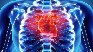 Pathology Cardiovascular 4 Embolism [upl. by Airliah252]