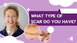 Are you wondering which type of Csection scar you have  HLP Therapy [upl. by Ahseina]