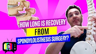 24How long is recovery from spondylolisthesis surgery [upl. by Atiniuq]