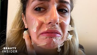 What It’s Like To Get A Chemical Peel For Acne Scars  Beauty Explorers  Beauty Insider [upl. by Lyrpa]