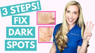 Fix Your Dark Spots in 3 Steps  Hyperpigmentation  Melasma  Skincare Made Simple [upl. by Eelaras]