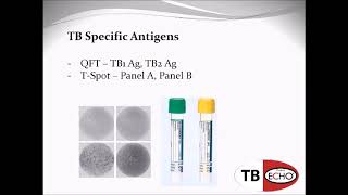 Interferon Gamma Release Assay  IGRA Assay  IGRA Test  Latent TB [upl. by Refinney]