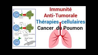 Cancer du Poumon Réponse de lImmunité AntiTumorale Thérapie cellulaire [upl. by Mcleod]