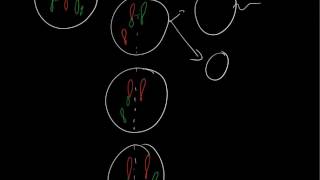 Robertsonian translocation 21q14q [upl. by Anitsud]