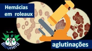 Hemácias em rouleaux aglutinação de hemácias [upl. by Sharona]