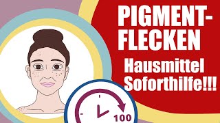 Pigmentflecken Hausmittel Soforthilfe 2021 100 Sekunden Haut [upl. by Yoo]