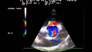 Herzultraschall Aortenklappeninsuffizienz beim Pferd [upl. by Selfridge]