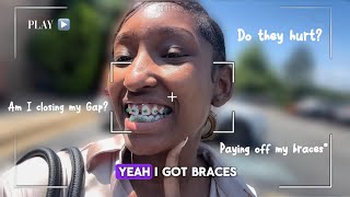 Braces Vlog Getting Braces For the First Time🦷 [upl. by Lloyd]