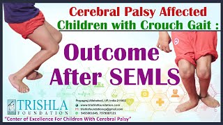 Cerebral Palsy Affected Children with Crouch Gait  Outcome After SEMLS  Trishla Foundation [upl. by Yelhs]