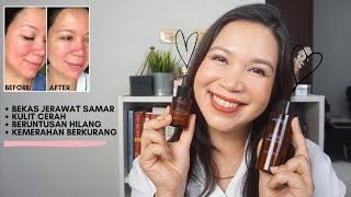 Review Lengkap amp Jujur Avoskin Miraculous Retinol [upl. by Ednargel8]