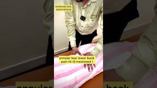 annular tear lower backpain l4l5 treatment  viralreels treanding yoga delhi explore watch [upl. by Anelem352]