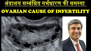 अंडाशय सम्बंधित गर्भधारण की समस्या  OVARIAN CAUSE OF INFERTILITY [upl. by Garrot]