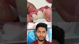 Denser treatment full complete dentist dental shortvideo duet [upl. by Eentroc]