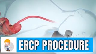 ERCP Endoscopic Retrograde Cholangiopancreatography procedure in 3D [upl. by Yeslah]