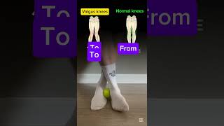 Valgus Deformity Exercise blackpink bornpink kpop shorts kpop exercise sports [upl. by Alekin]