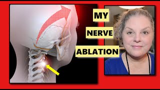 RADIOFREQUENCY NERVE ABLATION MY EXPERIENCE CERVICOGENIC MIGRAINES DAY ONE DAY 5 DAY 8 DAY 14 [upl. by Anavlys884]