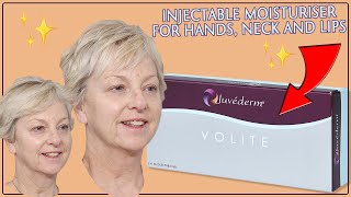 Juvederm Volite The Injectable Moisturiser Treatment for Hands Neck and Lips [upl. by Storz]